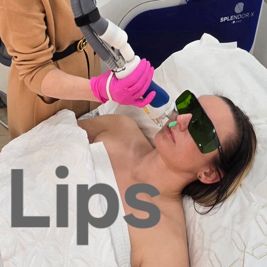 Lip laser hair removal ( includes 6 sessions)